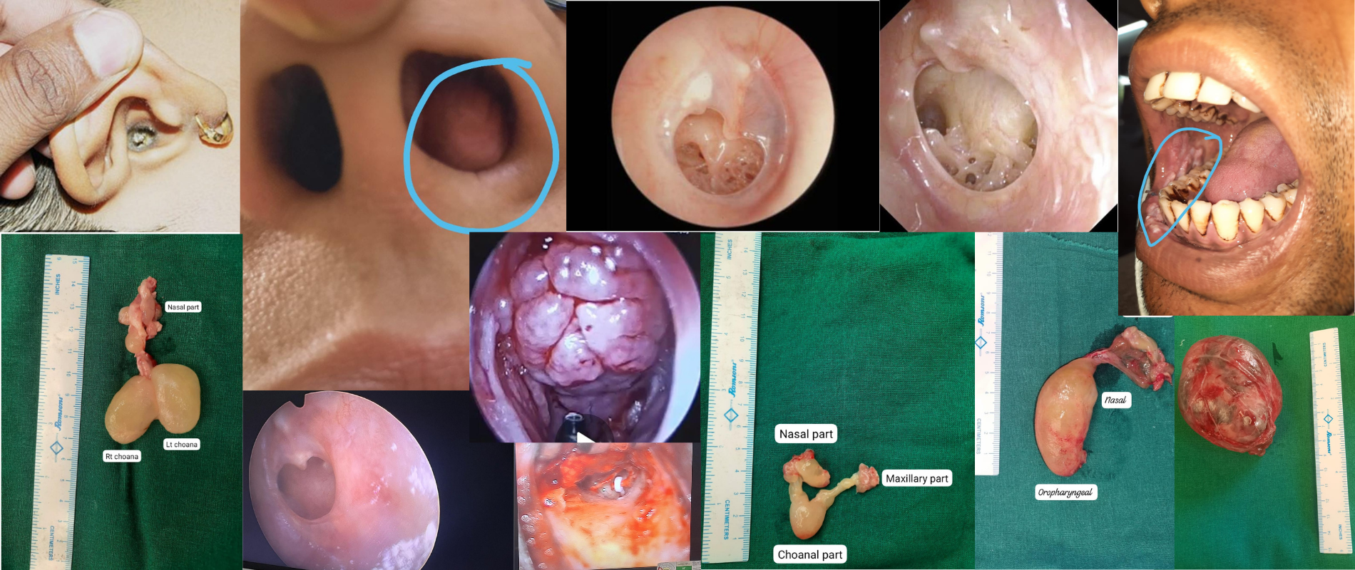 ENT treatment by Dr Swetal Mahajan, ENT specialist, Chembur.png